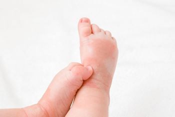 Infant legs with red dry skin. Suffering from allergy of milk formula or other food. Closeup.; Shutterstock ID 1588440745; purchase_order: DNC thumbnails ; job: Allergy papers; client: ; other: 