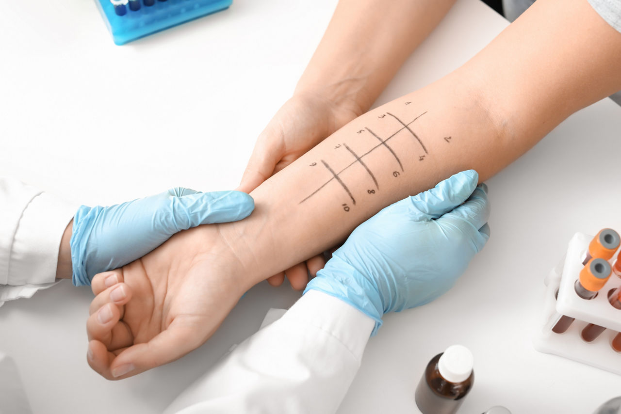 Young woman undergoing procedure of allergen skin tests in clinic; Shutterstock ID 1968769795; purchase_order: PR2138319; job: OMG1131771 ; client: Healthcare NPS; other: 336