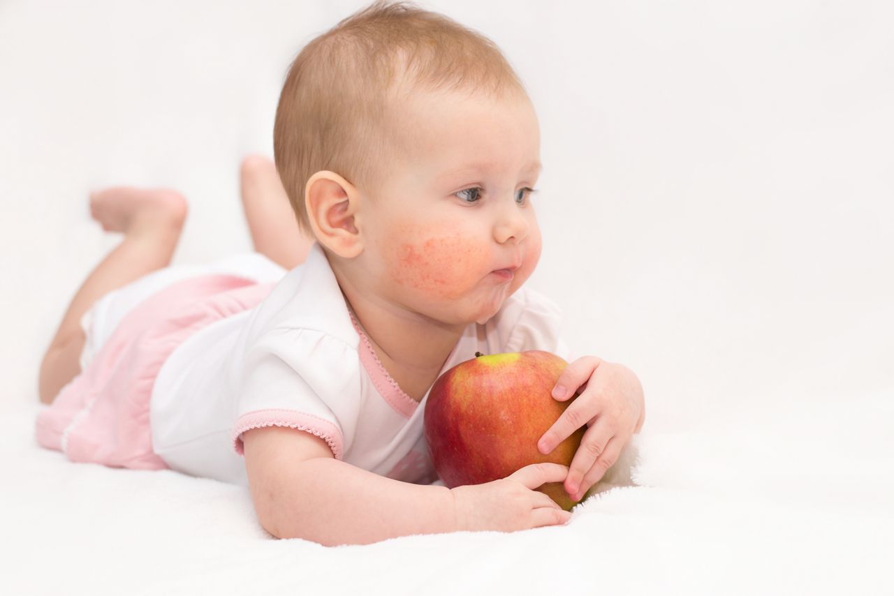 A cute baby girl with a dermatitis on her cheeks is eating a red apple on an isolated white background. Food allergy; Shutterstock ID 631308275; purchase_order: DNC Thumbnails; job: Articles ; client: ; other: Replace Fishwife