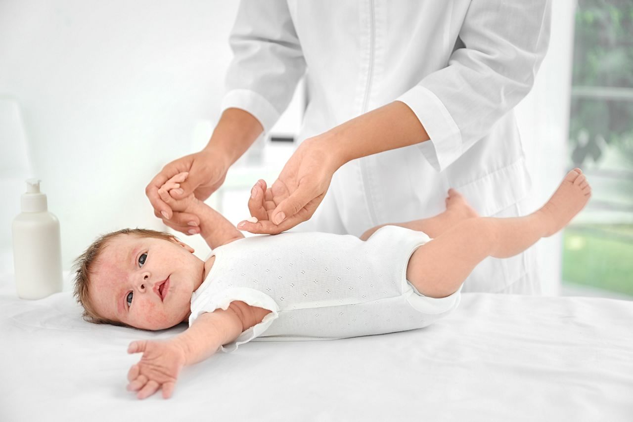 Adorable baby with skin allergy undergoing treatment in hospital; Shutterstock ID 732808273; purchase_order: DNC thumbnails ; job: Allergy papers; client: ; other: 