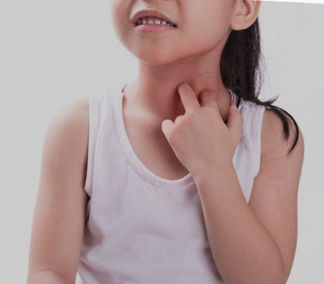 Girl sctratching allergy rash spot on neck